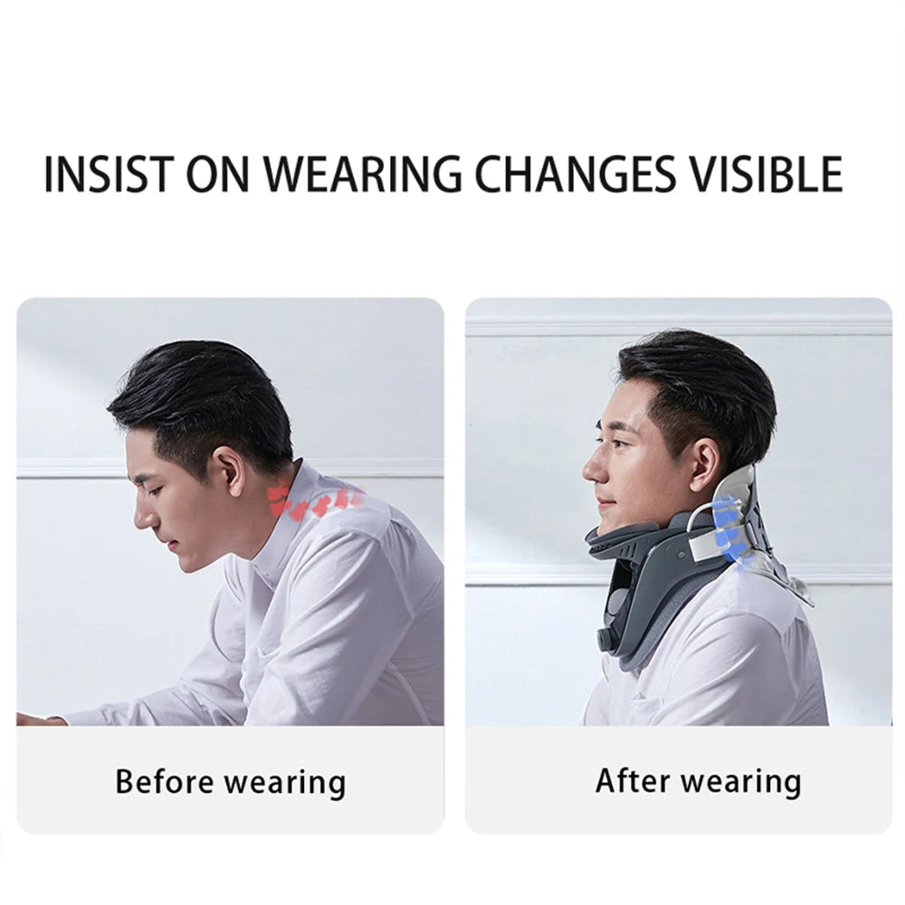 Before and after images demonstrating the effectiveness of the neck posture corrector brace for improved neck alignment.